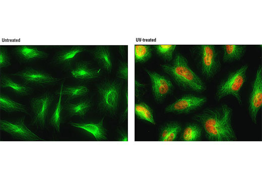  Immunofluorescent analysis of HeLa cells, untreated (left) or UV-treated (right), using Phospho-p38 MAPK (Thr180/Tyr182) (D3F9) XP® Rabbit mAb (Alexa Fluor® 555 Conjugate) (red) and β-Tubulin (9F3) Rabbit mAb (Alexa Fluor® 488 Conjugate) #3623 (green).