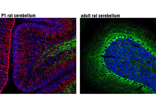  Confocal immunofluorescent analysis of P1 rat cerebellum (left) and adult rat cerebellum (right) using Nestin (Rat-401) Mouse mAb (Alexa Fluor® 555 Conjugate) (red) and Neurofilament-L (C28E10) Rabbit mAb (Alexa Fluor® 488 Conjugate) #8024 (green). Blue pseudocolor = DRAQ5® #4084 (fluorescent DNA dye).