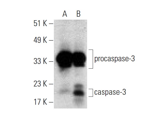  caspase-3 (31A1067): sc-56053. Western blot analysis of cleaved caspase-3 expression in untreated (A) and Staurosporine (sc-3510) treated (B) Jurkat whole cell lysates. Note upregulation of caspase-3 expression in lane B.