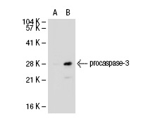  caspase-3 (3C119): sc-70497. Western blot analysis of caspase-3 expression in non-transfected: sc-117752 (A) and human caspase-3 transfected: sc-113427 (B) 293T whole cell lysates.