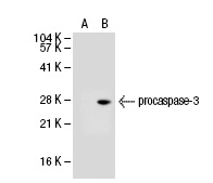  caspase-3 (3F49): sc-70498. Western blot analysis of caspase-3 expression in non-transfected: sc-117752 (A) and human caspase-3 transfected: sc-113427 (B) 293T whole cell lysates.