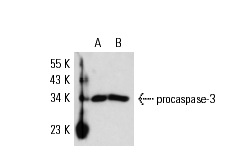  caspase-3 (3F49): sc-70498. Western blot analysis of caspase-3 expression in non-transfected: sc-117752 (A) and human caspase-3 transfected: sc-113427 (B) 293T whole cell lysates.