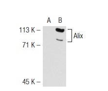  Alix (2H12): sc-53539. Western blot analysis of Alix expression in non-transfected: sc-117752 (A) and mouse Alix transfected: sc-118357 (B) 293T whole cell lysates.