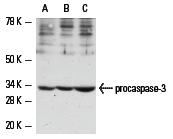  caspase-3 p11 (K-19): sc-1224. Western blot analysis of caspase-3 precursor expression in Jurkat (A), HuT 78 (B) and CCRF-HSB-2 (C) whole cell lysates.