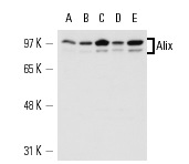  Alix (2H12): sc-53539. Western blot analysis of Alix expression in HeLa (A), Jurkat (B), K-562 (C), THP-1 (D) and U-937 (E) nuclear extracts.