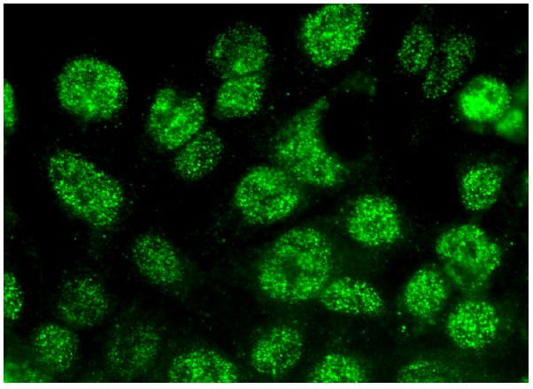  caspase-3 p17 (D-12): sc-373730. Immunofluorescence staining of formalin-fixed HepG2 cells showing nuclear localization.