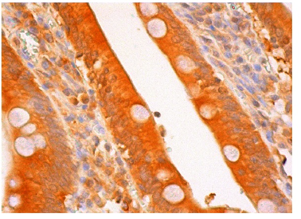  caspase-3 p17 (H-60): sc-98785. Immunoperoxidase staining of formalin fixed, paraffin-embedded human duodenum tissue showing cytoplasmic and nuclear staining of glandular cells.