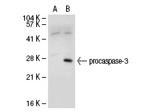  caspase-3 p17 (S-19): sc-22139. Western blot analysis of caspase-3 expression in non-transfected: sc-117752 (A) and human caspase-3 transfected: sc-113427 (B) 293T whole cell lysates.