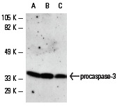  caspase-3 p20 (N-19): sc-1226. Western blot analysis of caspase-3 precursor expression in Jurkat (A), HuT 78 (B) and CCRF-HSB-2 (C) whole cell lysates.