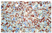  caspase-3 p20 (N-19): sc-1226. Immunoperoxidase staining of formalin-fixed, paraffin-embedded normal human lymph node showing cytoplasmic staining of lymphoid cells.