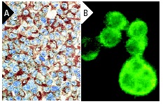  caspase-3 p20 (N-19): sc-1226. Immunoperoxidase staining of formalin-fixed, paraffin-embedded normal human lymph node showing cytoplasmic staining of lymphoid cells (A). Immunofluorescence staining of methanol-fixed Hut 78 cells showing cytoplasmic localization (B).