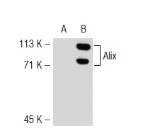  Alix (3A9): sc-53538. Western blot analysis of Alix expression in non-transfected: sc-117752 (A) and mouse Alix transfected: sc-118357 (B) 293T whole cell lysates.