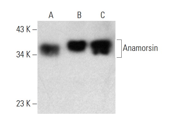  Anamorsin (A-3): sc-271298. Western blot analysis of Anamorsin expression in Hep G2 (A), MIA PaCa-2 (B) and NTERA-2 cl.D1 (C) whole cell lysates.