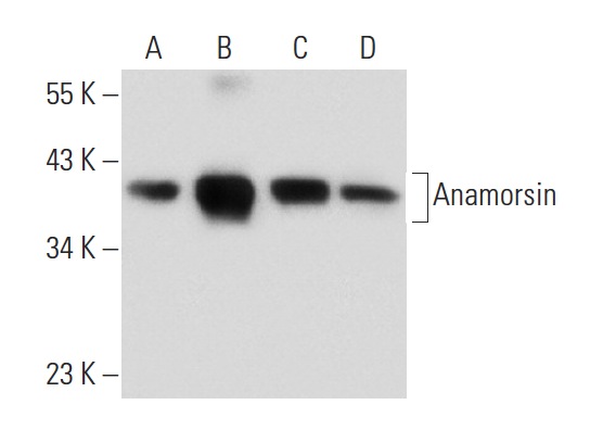  Anamorsin (A-3): sc-271298. Western blot analysis of Anamorsin expression in HeLa (A), COLO 320DM (B), T24 (C) and Hep G2 (D) whole cell lysates.