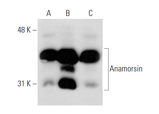  Anamorsin (FL-312): sc-134449. Western blot analysis of Anamorsin expression in non-transfected 293T: sc-117752 (A), mouse Anamorsin transfected 293T: sc-118386 (B) and HeLa (C) whole cell lysates.