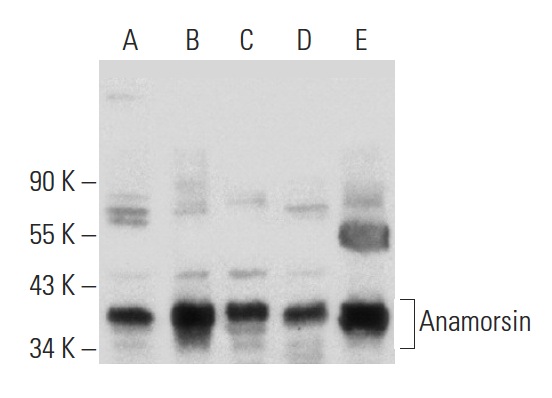  Anamorsin (FL-312): sc-134449. Western blot analysis of Anamorsin expression in HeLa (A), COLO 320DM (B), T24 (C) and Hep G2 (D) whole cell lysates and mouse testis tissue extract (E).