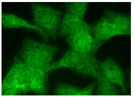  Anamorsin (FL-312): sc-134449. Immunofluorescence staining of formalin-fixed Hep G2 cells showing nuclear and cytoplasmic localization.