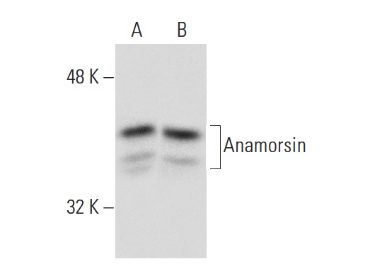  Anamorsin (G-14): sc-49601. Western blot analysis of Anamorsin expression in MIA PaCa-2 (A) and NTERA-2 cl.D1 (B) whole cell lysates.