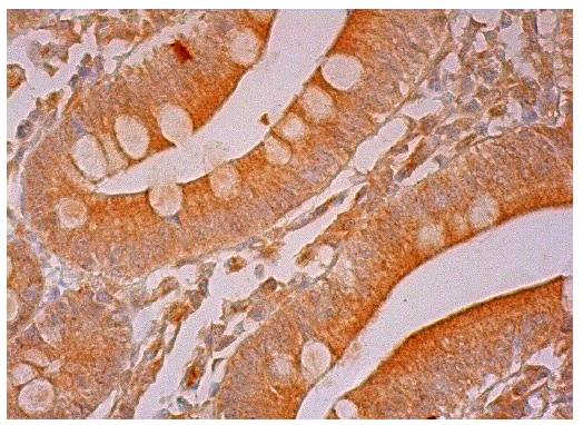  CDCP1 (R-14): sc-32848. Immunoperoxidase staining of formalin fixed, paraffin-embedded human small intestine tissue showing cytoplasmic staining of glandular cells and interstitial cells.