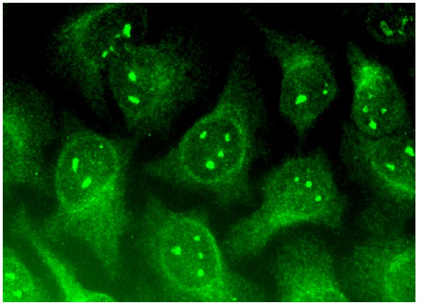  Chibby (C-10): sc-393295. Immunofluorescence staining of methanol-fixed HeLa cells showing nucleolar, nuclear and cytoplasmic localization.