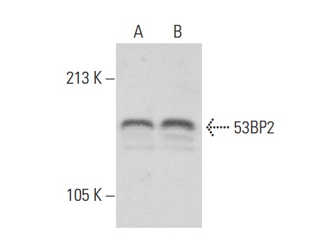  53BP2 (N-15): sc-10922. Western blot analysis of 53BP2 expression in HeLa (A) and MCF7 (B) whole cell lysates.