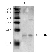  CIDE-B (E-19): sc-8733. Western blot analysis of CIDE-B expression in mouse heart (A) and mouse liver (B) tissue extracts.