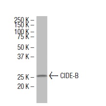  CIDE-B (5X): sc-101244. Western blot analysis of CIDE-B expression in Hep G2 whole cell lysate.