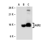  AGR2 (T-17): sc-54561. Western blot analysis of AGR2 expression in non-transfected 293: sc-110760 (A), human AGR2 transfected 293: sc-112951 (B) and MCF7 (C) whole cell lysates.