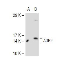  AGR2 (T-17): sc-54561. Western blot analysis of AGR2 expression in non-transfected: sc-117752 (A) and mouse AGR2 transfected: sc-118272 (B) 293T whole cell lysates.