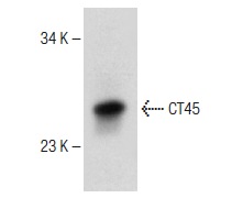  CT45 (G-15): sc-138225. Western blot analysis of CT45 expression in L-428 whole cell lysate.