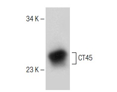  CT45 (N-20): sc-138226. Western blot analysis of CT45 expression in L-428 whole cell lysate.