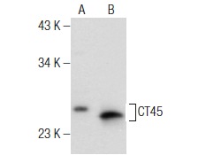  CT45 (N-20): sc-138226. Western blot analysis of CT45 expression in T-47D (A) and K-562 (B) whole cell lysates.