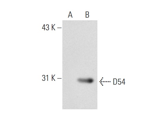  D54 (N-15): sc-85523. Western blot analysis of D54 expression in non-transfected: sc-117752 (A) and mouse D54 transfected: sc-110149 (B) 293T whole cell lysates.