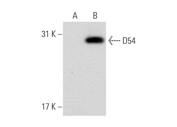  D54 (N-15): sc-85523. Western blot analysis of D54 expression in non-transfected: sc-110760 (A) and human D54 transfected: sc-110549 (B) 293 whole cell lysates.