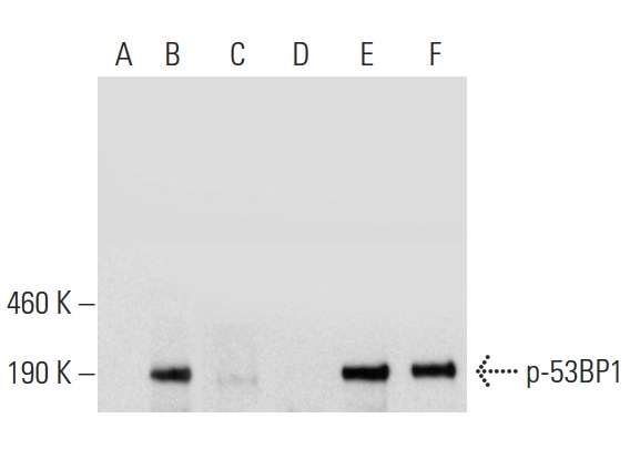  Western blot analysis of 53BP1 phosphorylation in untreated (A,D), UV treated (B,E) and UV and lambda protein phosphatase (sc-200312A) treated (C,F) HeLa whole cell lysates. Antibodies tested include p-53BP1 (38.Ser 25): sc-135748 (A,B,C) and 53BP1 (H-300): sc-22760 (D,E,F).