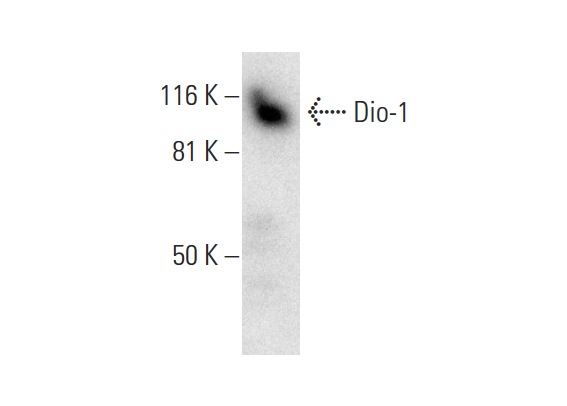  Dio-1 (C-10): sc-393453. Western blot analysis of Dio-1 expression in Jurkat nuclear extract.