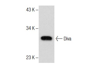  Diva (A-18): sc-8739. Western blot analysis of Diva expression in IB4 whole cell lysate.