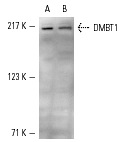  DMBT1 (N-20): sc-9572. Western blot analysis of DMBT1 expression in HeLa (A) and A-431 (B) whole cell lysates.