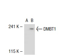  DMBT1 (M-16): sc-14249. Western blot analysis of DMBT1 expression in non-transfected: sc-117752 (A) and human DMBT1 transfected: sc-112667 (B) 293T whole cell lysates.