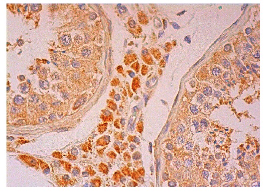  DMBT1 (D-20): sc-9573. Immunoperoxidase staining of formalin fixed, paraffin-embedded human testis tissue showing cytoplasmic staining of cells in seminiferous ducts and Leydig cells.