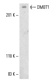  DMBT1 (P-20): sc-14246. Western blot analysis of DMBT1 expression in EOC 20 whole cell lysate.