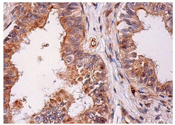  DMBT1 (H-130): sc-28239. Immunoperoxidase staining of formalin fixed, paraffin-embedded human epididymis tissue showing cytoplasmic staining of glandular cells.