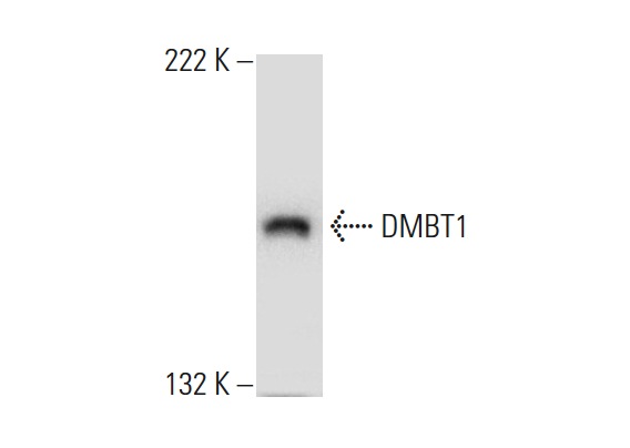  DMBT1 (H-130): sc-28239. Western blot analysis of DMBT1 expression in HeLa whole cell lysate.