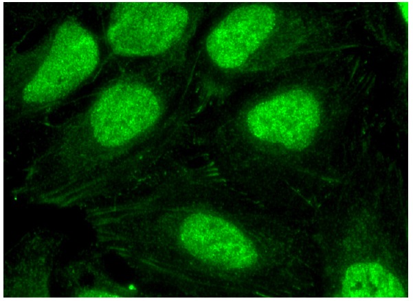  DNA-PK<sub>CS</sub> (E-3): sc-390495. Immunofluorescence staining of methanol-fixed HeLa cells showing nuclear localization.