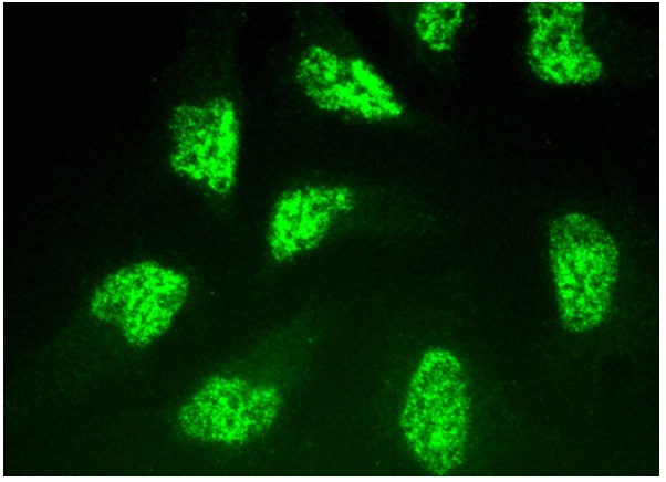  DNA-PK<sub>CS</sub> (E-6): sc-390698. Immunofluorescence staining of methanol-fixed HeLa cells showing nuclear localization.