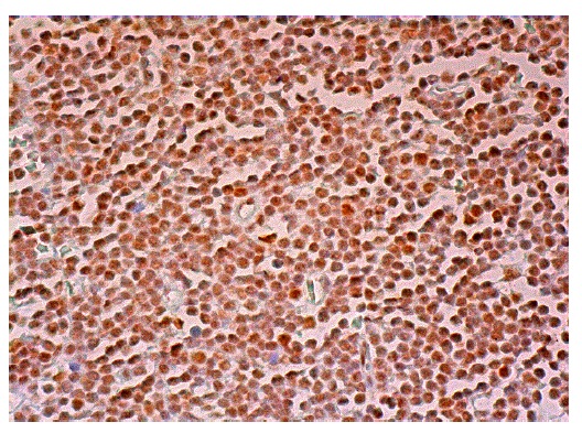  DNA-PK<sub>CS</sub> (E-6): sc-390698. Immunoperoxidase staining of formalin fixed, paraffin-embedded human lymph node tissue showing nuclear staining of cells in germinal centers and cells in non-germinal centers.