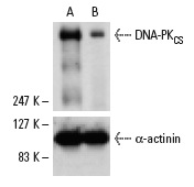  DNA-PK<sub>CS</sub> siRNA (h): sc-35200. Western blot analysis of DNA-PK<sub>CS</sub> expression in non-transfected control (A) and DNA-PK<sub>CS</sub> siRNA transfected (B) HeLa cells. Blot probed with DNA-PK<sub>CS</sub> (G-4): sc-5282. α-actinin (H-2): sc-17829 used as specificity and loading control.