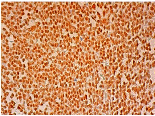  DNA-PK<sub>CS</sub> (G-12): sc-390849. Immunoperoxidase staining of formalin fixed, paraffin-embedded human lymph node tissue showing nuclear staining of cells in germinal center and cells in non-germinal center.