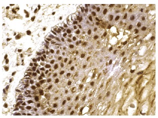  DNA-PKCS (C-19): sc-1552. Immunoperoxidase staining of formalin fixed, paraffin-embedded human cervix tissue showing nuclear staining of squamous epithelial cells.