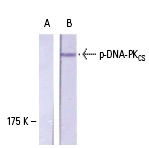  p-DNA-PK<sub>CS</sub> (Thr 2609): sc-101664. Western blot analysis of phosphorylated DNA-PK<sub>CS</sub> expression in untreated (A) and hydroxyurea-treated (B) K-562 whole cell lysates.